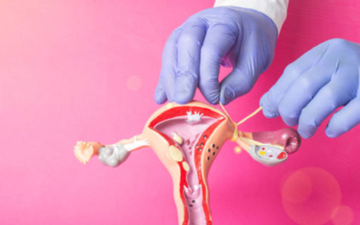 Ectopic Pregnancy After Tubal Ligation: What You Need to Know