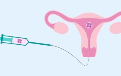 Things to Avoid After IUI Treatment