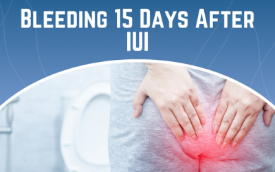 Bleeding 15 Days After IUI