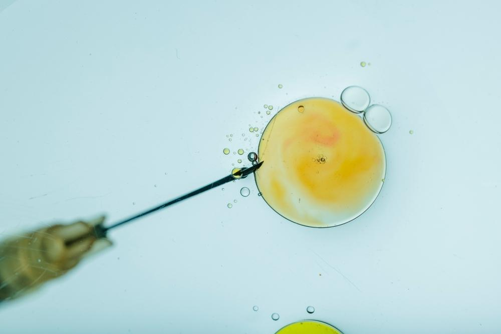 What are the Side Effects of IVF? What are the Side Effects of IVF?