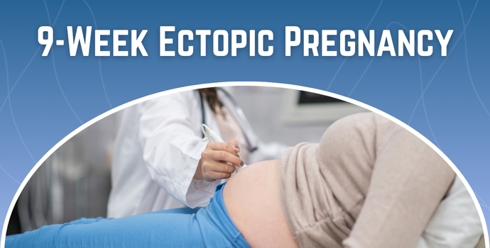 9-Week Ectopic Pregnancy
