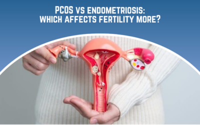 PCOS vs endometriosis:which affects fertility more?