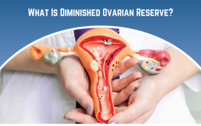 What is Diminished Ovarian Reserve?