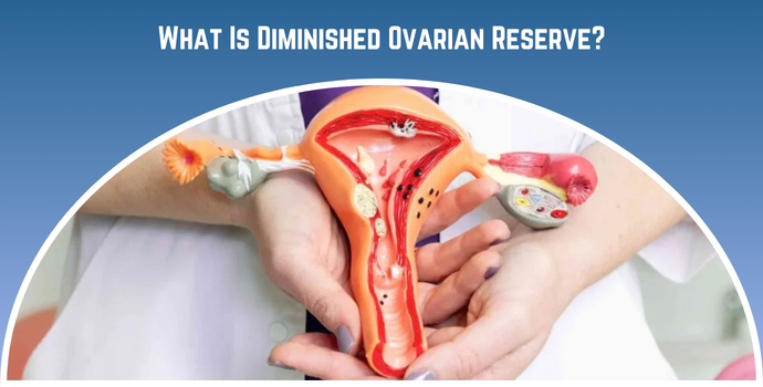 What Is Diminished Ovarian Reserve