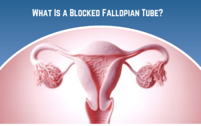 What is Blocked Fallopian Tube and Fertility?