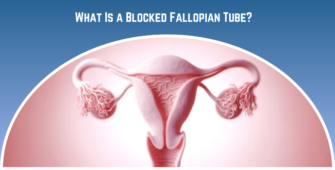 What Is a Blocked Fallopian Tube
