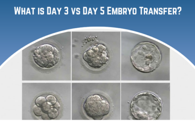 What is Day 3 vs Day 5 Embryo Transfer?