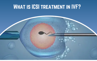 What is ICSI treatment in IVF?