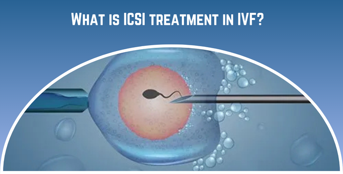 What is ICSI treatment in IVF?