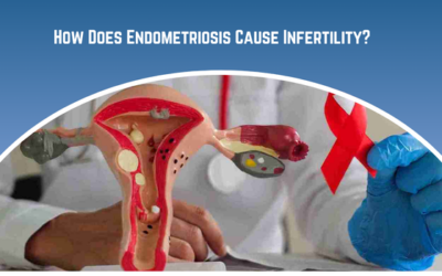 How Does Endometriosis Cause Infertility?