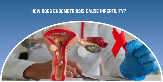 How Does Endometriosis Cause Infertility