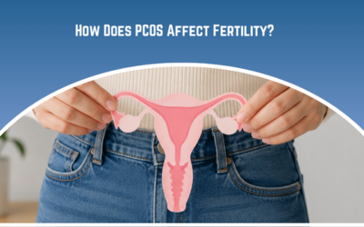 How Does PCOS Affect Fertility?