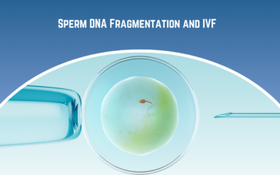 What Is Sperm DNA Fragmentation and How Does It Affect IVF?