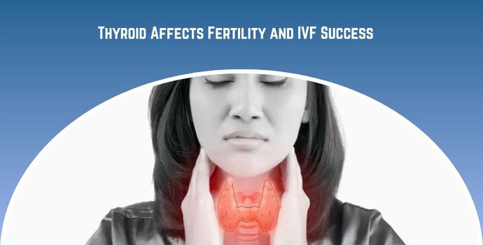 Thyroid Affects Fertility and IVF Success